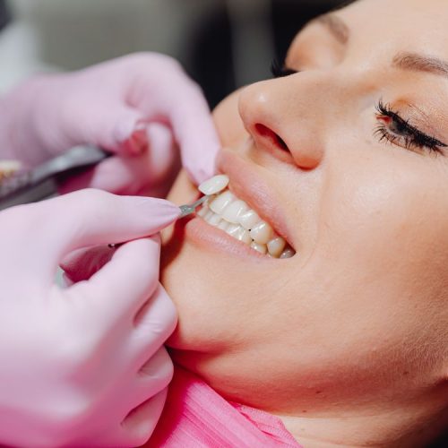 Dentist applying a porcelain veneer to a patient’s teeth in a modern dental clinic