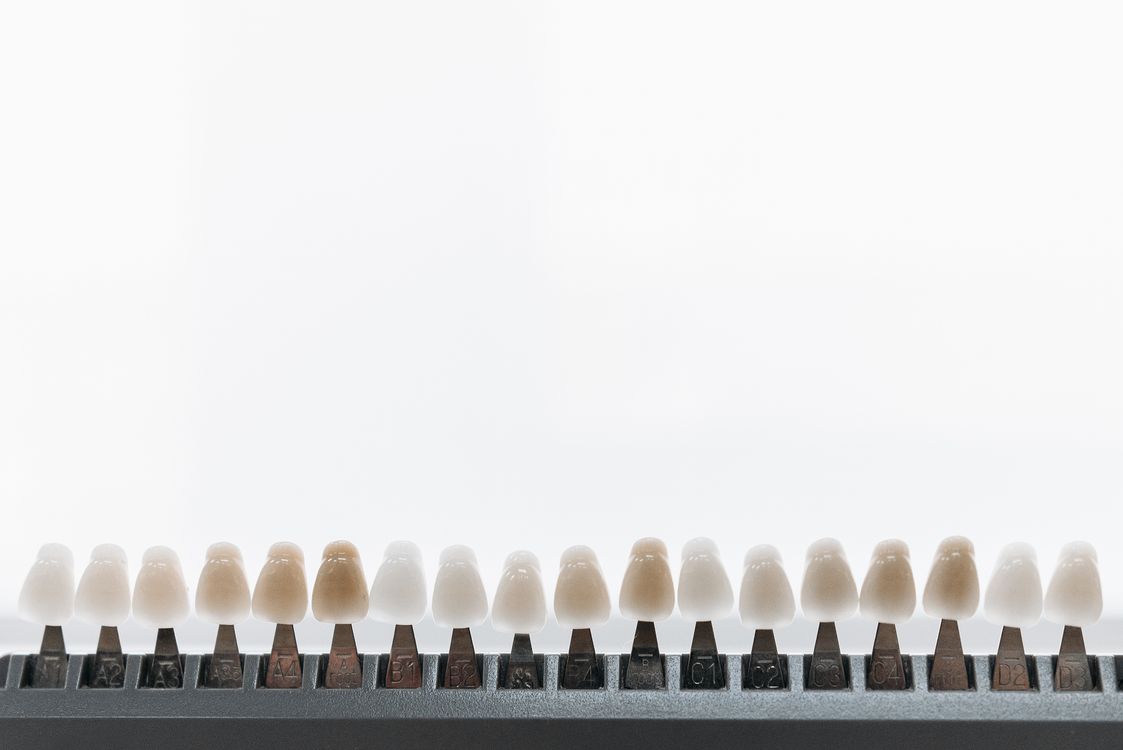 Dental veneers and crowns displayed in a shade guide showing different tooth color options